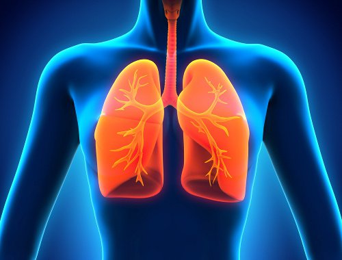 Что такое рак лёгкого? Какие формы рака лёгкого различают?